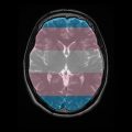 Neuroscience and Transgender People