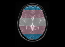 Neuroscience and Transgender People